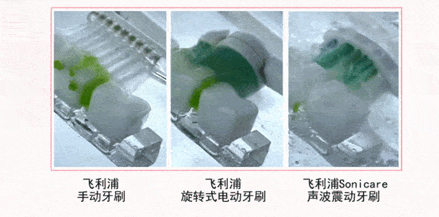 呵护全家口腔健康 飞利浦电动牙刷现年促销(图4) 呵护全家口腔健康 飞利浦电动牙刷现年促销