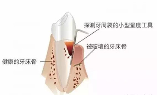 牙齿种植需要哪些条件(图3)