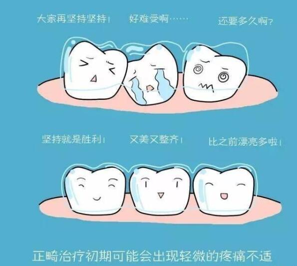 成年人矫正牙齿的好处(图2)