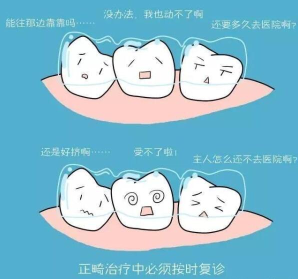 成年人矫正牙齿的好处(图3)