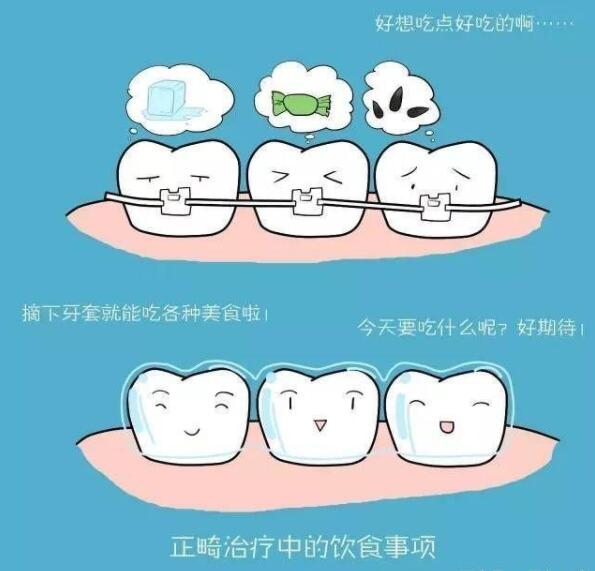 成年人矫正牙齿的好处(图4)