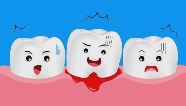 牙龈出血、口臭……口腔细菌会让你掉牙！(图1)