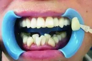 刷牙？不刷牙？坐月子真的不能刷牙吗？(图1)