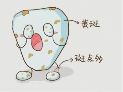 中国牙科网：牙齿会发黄是什么原因？(图3)