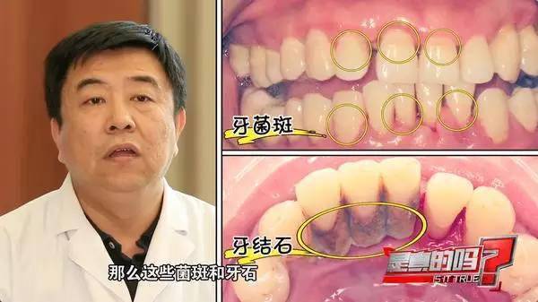 牙龈出血，真的是因为体内缺少维生素C吗？(图3)