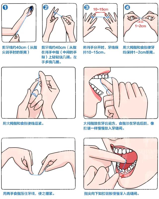 为什么不能使用牙签剔牙?(图2)
