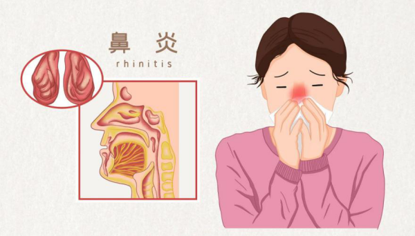 刷牙时总恶心干呕是什么原因？(图4)