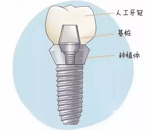 种植的流程和价钱是什么？(图1)